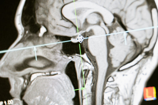 A substantial increase in the respiratory ventilation and brain oxygen concentration